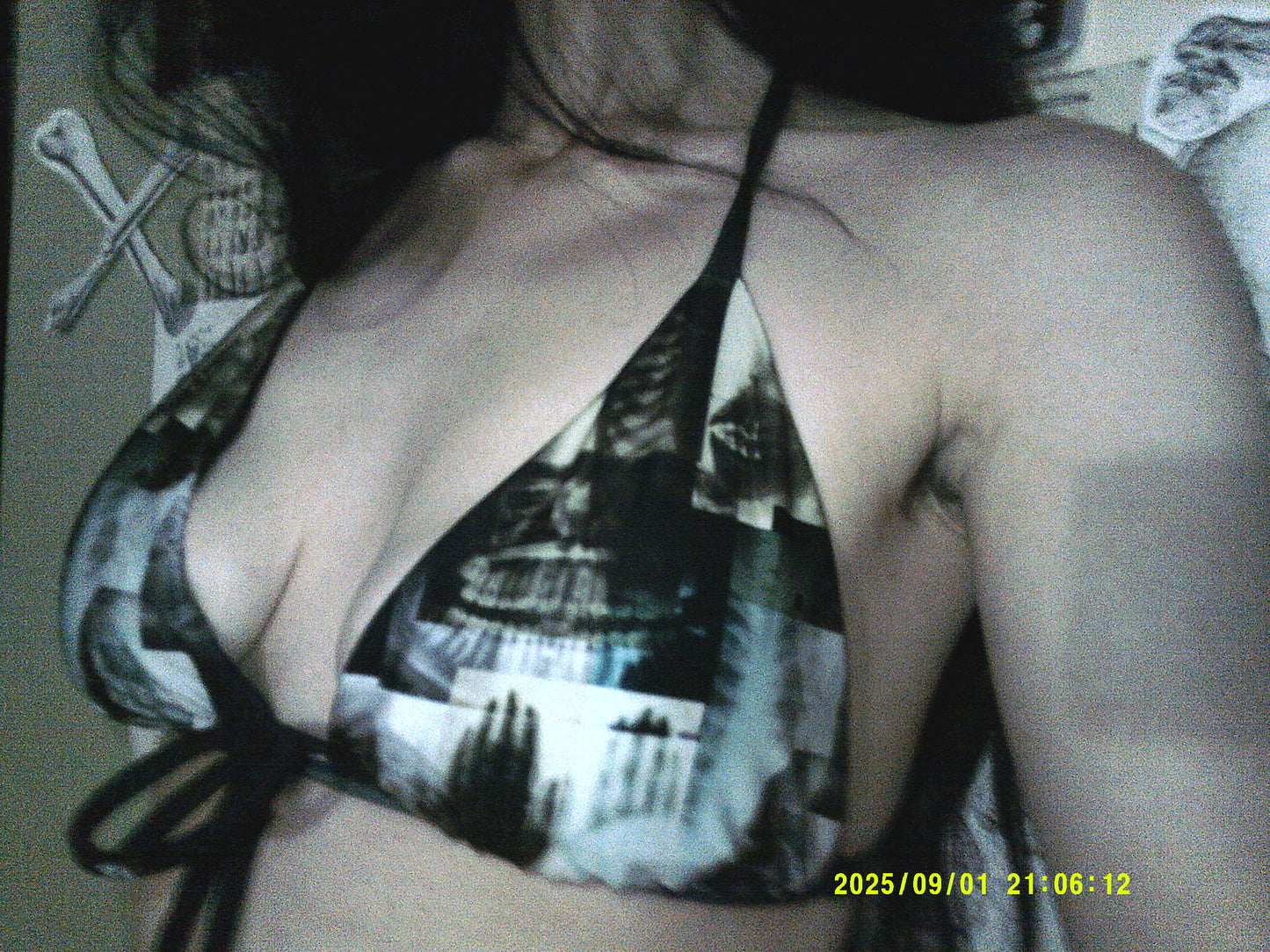 X-ray bikini