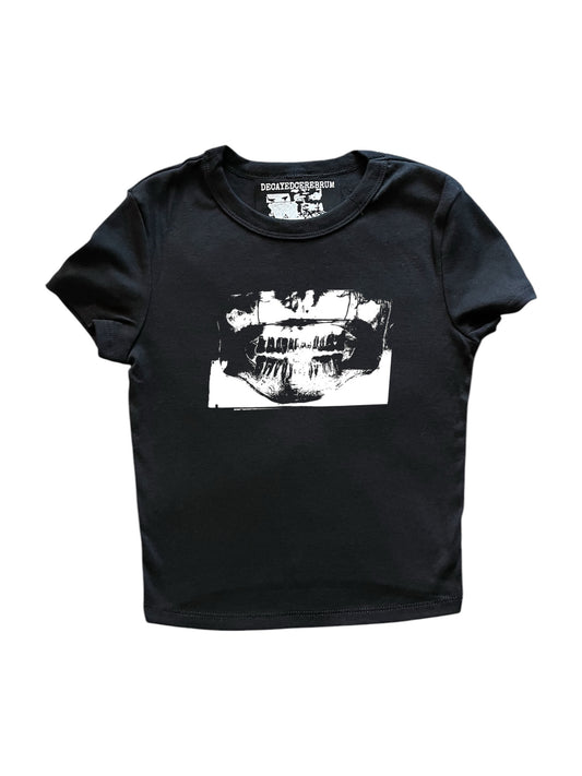 Teeth X-Ray baby tee